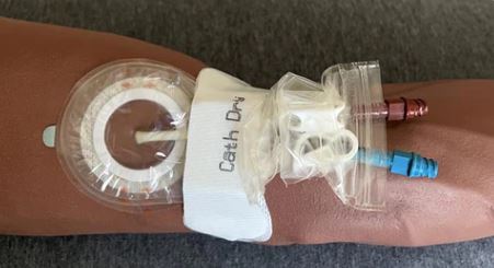 CATH DRY PD 4/Pack **One Pack per Month**