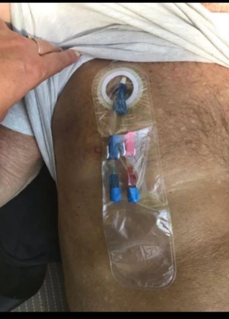 CATH DRY XL 12/Pack **One Pack per Month**